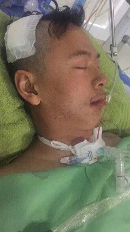 梦境的启示，从自己头上有个斑梦见别人笑自己头上有个疤像个逼解读内心深层